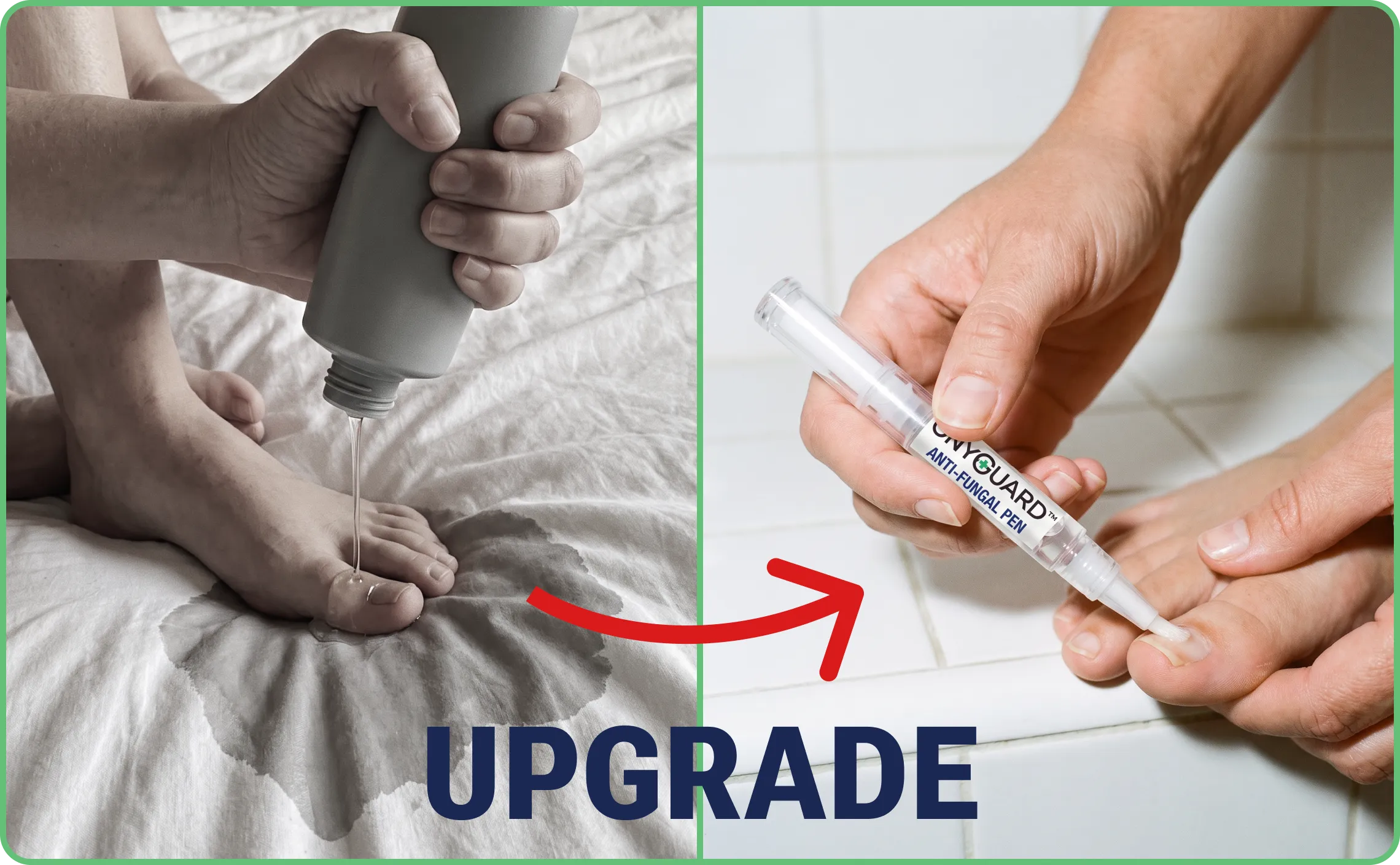 Upgrade to Ultra Strength Anti-Fungal Nail Pen Formula